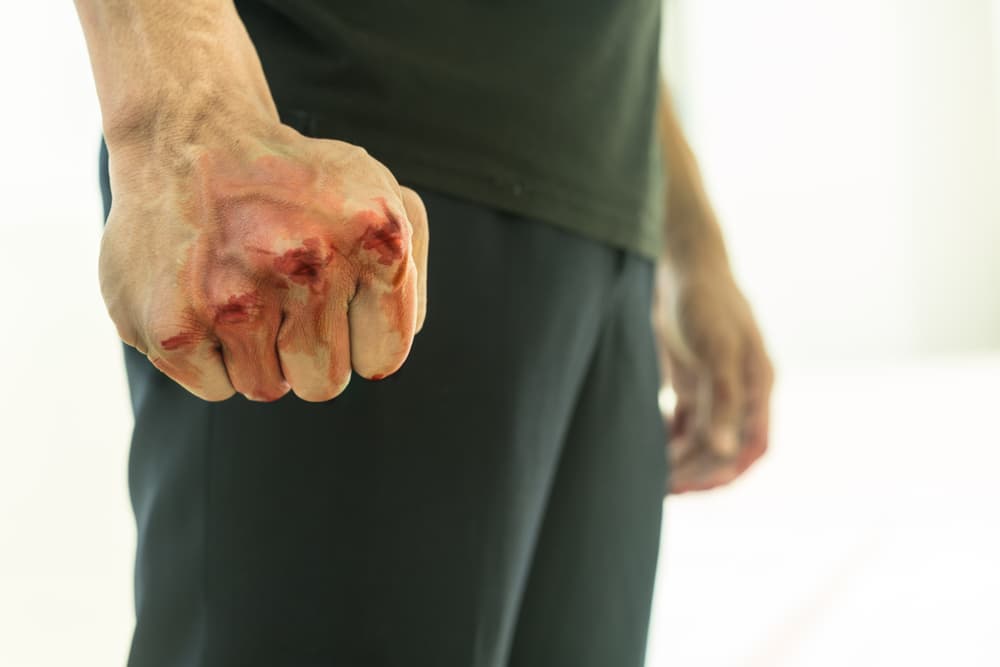 assault lawyer san diego ca